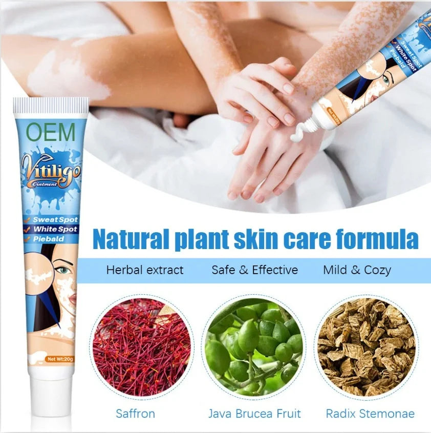 SELUMB Vitiligo & Pityriasis Alba Treatment Cleansing Soft Cream 20g for Body All Skin Types External Use