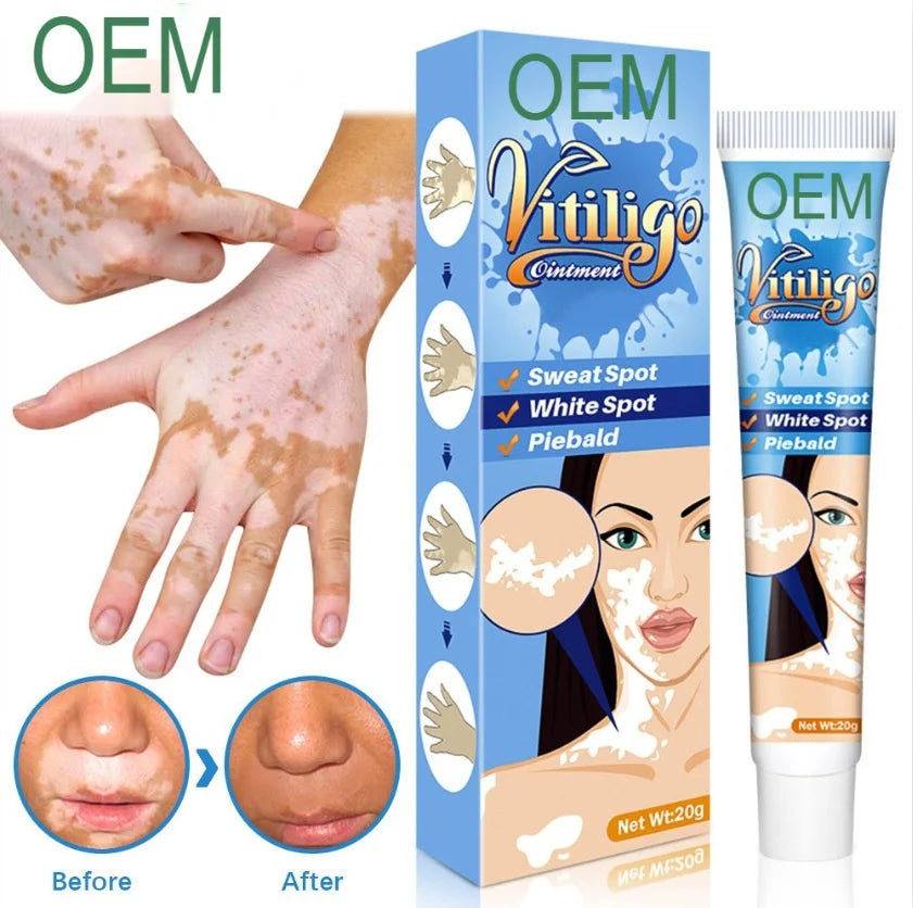 SELUMB Vitiligo & Pityriasis Alba Treatment Cleansing Soft Cream 20g for Body All Skin Types External Use